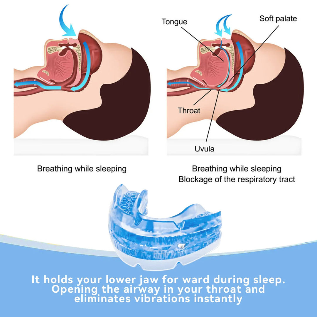 BPA-free unisex dental guard, designed as an anti-snore mouth guard for comfortable, restful sleep & snoring relief.