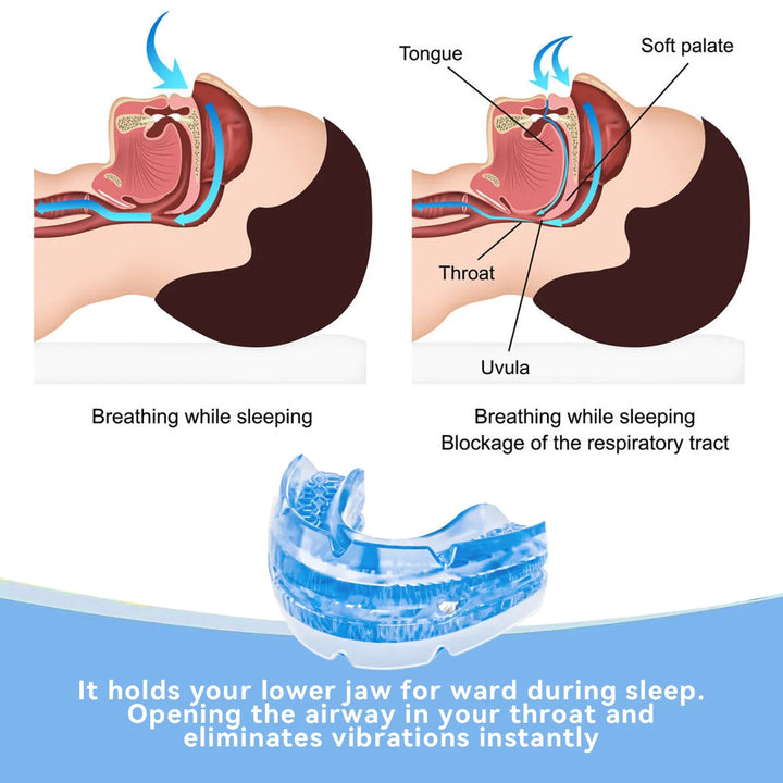 BPA-free unisex dental guard, designed as an anti-snore mouth guard for comfortable, restful sleep & snoring relief.