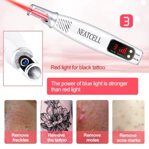 Professional-grade portable laser pen for safe and effective tattoo & blemish removal.